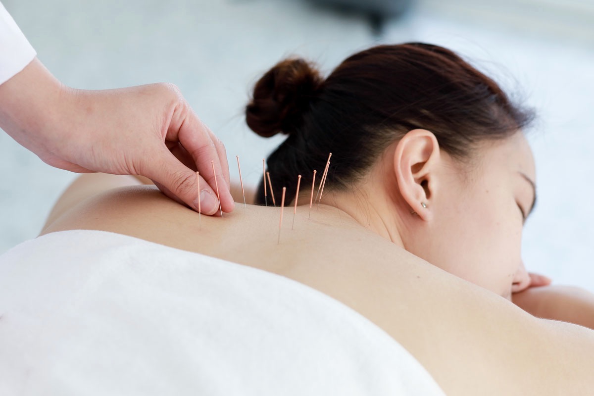 Acupuncture Clinic Specialist In Salt Lake City