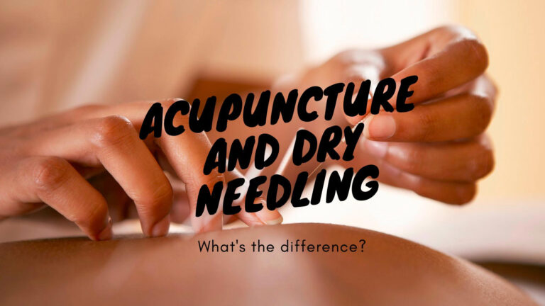 dry needling acupuncture salt lake city