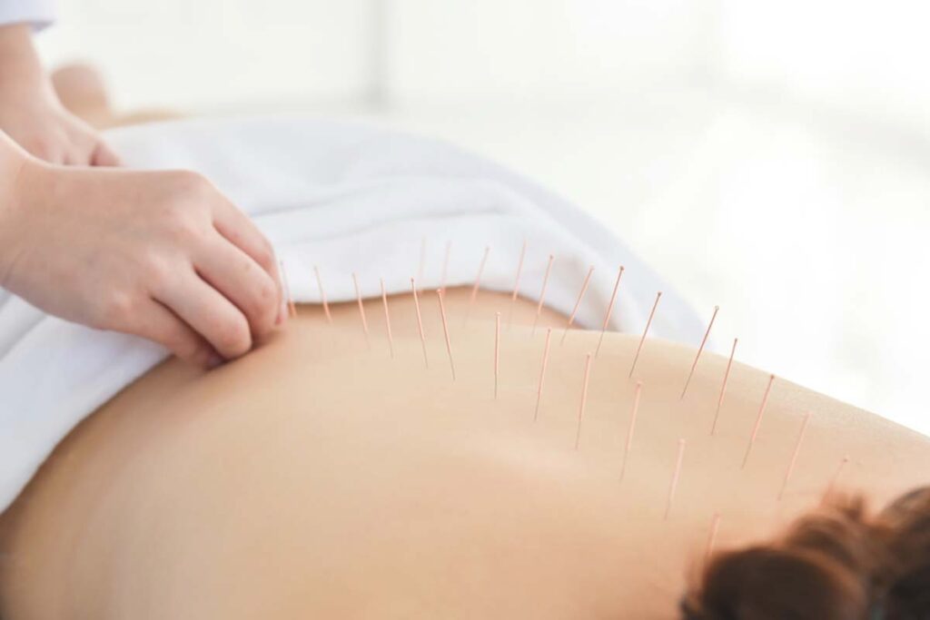 acupuncturist-for-pain-salt-lake-city