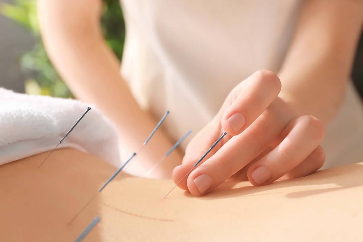 Acupuncture Clinic for pain relief near me in salt lake city